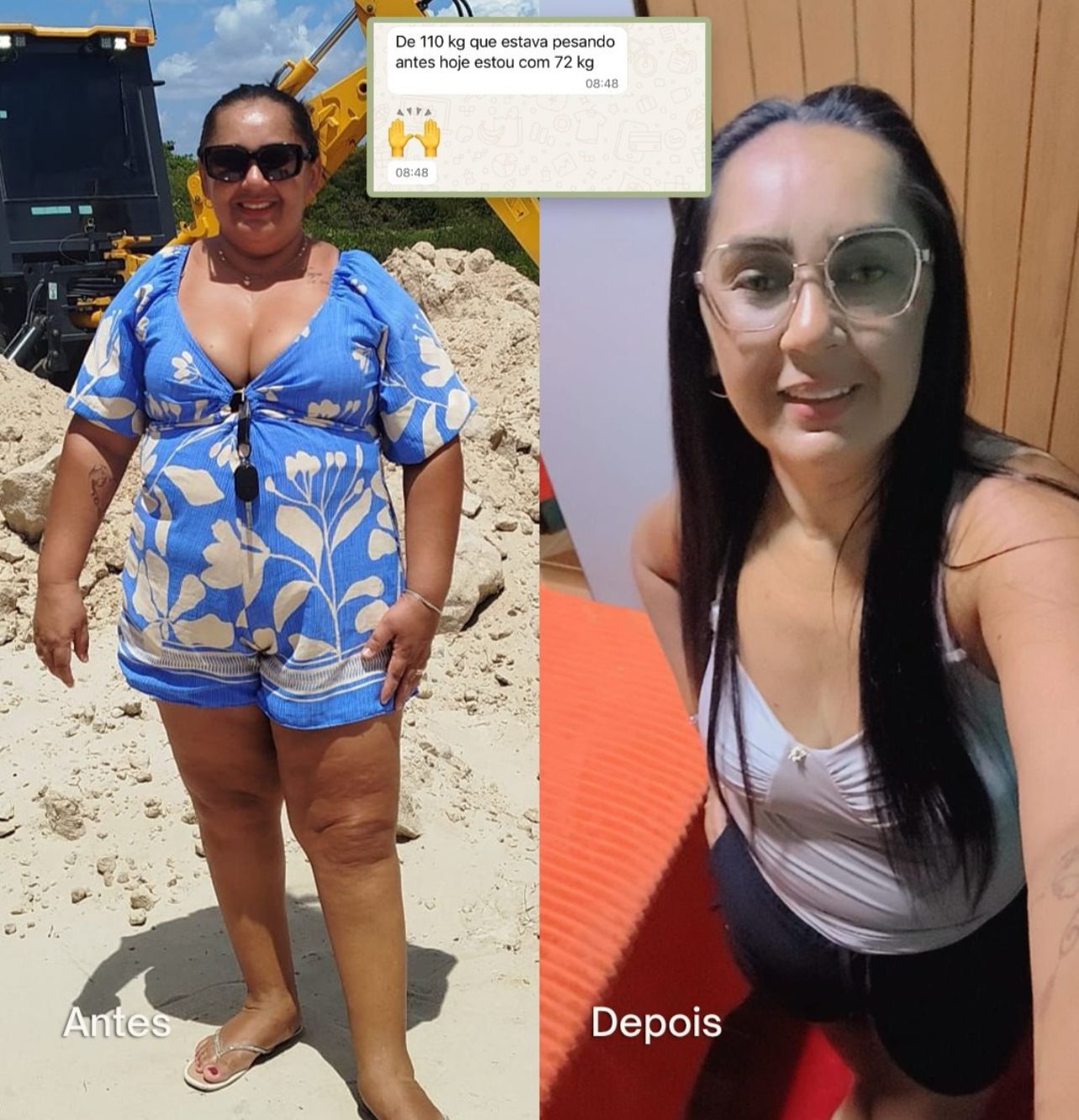 Antes e depois 3
